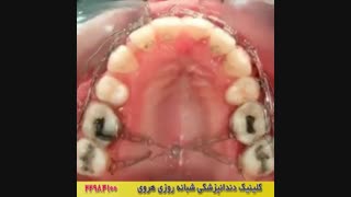 فیلم کوتاه از ارتودنسی دندان ها