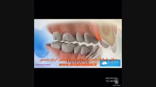 ارتودنسی قبل و بعد