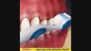 فیلم آموزش روش صحیح مسواک زدن