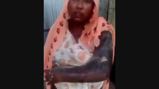 سوزاندن زنان میانماری