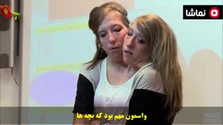 دوقلوهای بهم چسبیده ای که حالا معلم مدرسه هستند