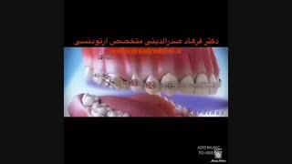 متخصص ارتودنسی در غرب تهران