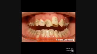 مراحل ارتودنسی