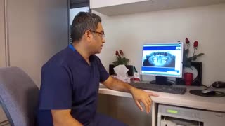 ایمپلنت ( کاشت دندان ) | کلینیک دندانپزشکی مهر زعفرانیه