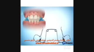 متخصص ارتودنسی در غرب تهران