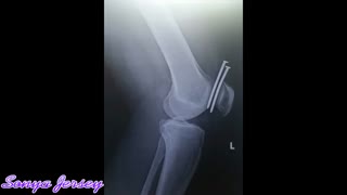 مجموعه اتفاقاتی که باور کردنشون سخته.