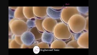 کاربرد دستگاه کرایولیپولیز