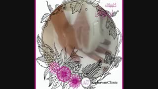 افزایش بی نظیر لطفات پوست با آر اف