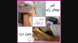 رفع موهای زاید دست با لیزر