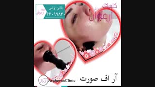 آر اف صورت