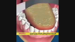 چطور | کاهش بوی بد دهان