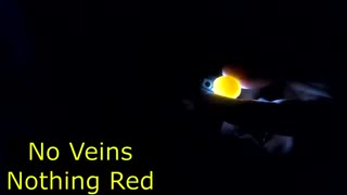 ساخت دستگاه نطفه سنج