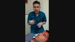 میکرونیدلینگ