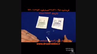 الاستیک ارتودنسی | دکتر فرهاد صدرالدینی روکش دندان