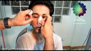 نحوه چسب زدن بینی پس از عمل زیبایی