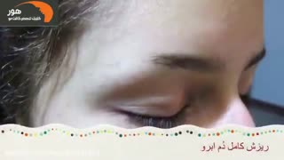 کاشت ابرو | کاشت ابرو در اصفهان | ترمیم ابرو | کاشت ابروی طبیعی