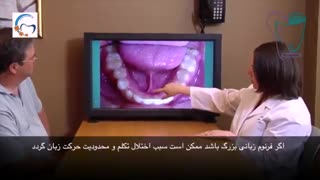 جراحی فرنوم | سیمادنت