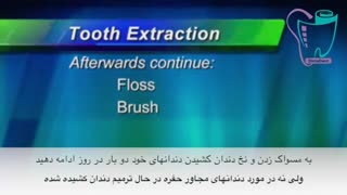 کشیدن دندان | سیمادنت