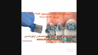 آموزش مسواک زدن ارتودنسی | دکتر فرهاد صدرالدینی عصب‌کشی