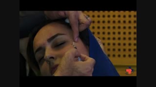 تزریق بوتاکس