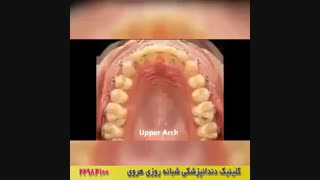 ارتودنسی دندان رو اینجا ببینید