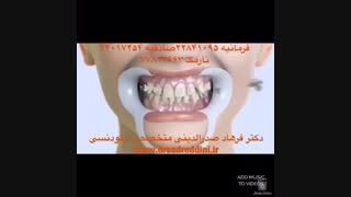 تاثیر ارتودنسی بر زیبایی | دکتر فرهاد صدرالدینی دندان شیری