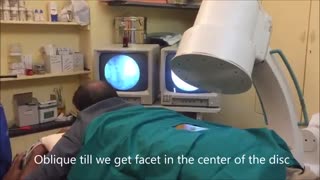 ازن تراپی دیسک کمر