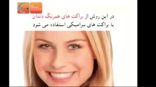 ارتودنسی نامرئی چیست؟ | دکتر مسعود داوودیان