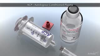 کیت جمع آوری فراورده های خونی prp