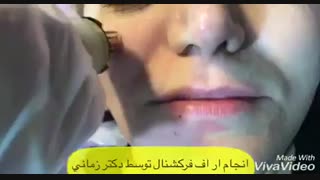 آراف فرکشنال پیشگیری از پیری