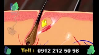 کاشت ابرو چگونه است - حتما ببینید