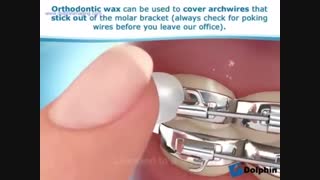 اورژانس های ارتودنسی | دکتر مسعود داوودیان