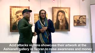 گزارش خبرگزاری فرانسه از نمایشگاه آثارچوبی ویژه قربانیان اسیدپاشی