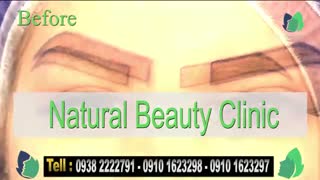 نمونه کار کاشت ابرو- قبل و بعد از کاشت!- نچرال بیوتی