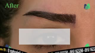 نمونه کار کاشت ابرو- قبل و بعد از کاشت!- نچرال بیوتی