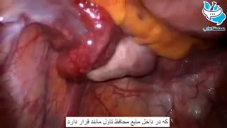تصاویر واقعی از رحم در زمان تخمک گذاری