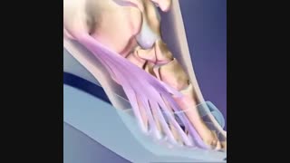 مضرات پوشیدن دمپایی نا مناسب