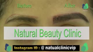 نمونه کار کاشت ابرو- قبل و بعد از کاشت !!!- نچرال بیوتی