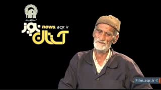 استا اسدالله زرین مهر جراحی زیبایی پلک