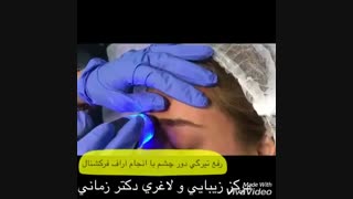 آراف فرکشنال برای رفع تیرگی و چروک دور چشم