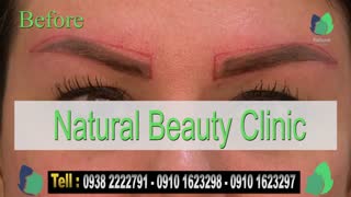 نمونه کار کاشت ابرو- قبل و بعد از کاشت !!!- نچرال بیوتی