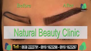 نمونه کار کاشت ابرو- قبل و بعد از کاشت !!!- نچرال بیوتی