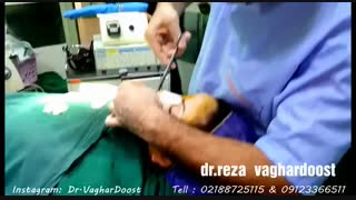 فیلم عمل زیبایی بینی (دکتر رضا وقردوست)( پارت 9)