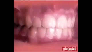 ارتودنسی یکی از روش‌های درمانی در دندانپزشکی است که برای اصلاح نامنظمی‌های دندانی به کار می‌آید.