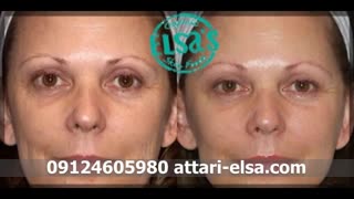 فواید و کاربردهای روغن خراطین