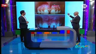 عوارض درمانهای ناصحیح ارتودنسی | دکتر مسعود داوودیان