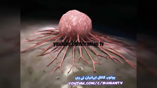 ساپادیل یا سوپر میوه چیست؟