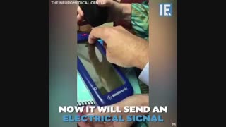 چگونه با یک ابزار کاشتنی می توان موجب کنترل  لرزش شدید بیمار پارکینسونی   شد.