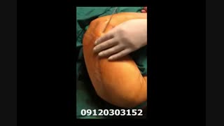 لیپوماتیک - دکتر ابدالی - 22807060 درمان سلولیت