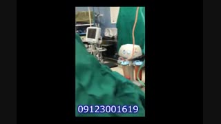 لیپوماتیک - دکتر ابدالی - 22807060 اصلاح طرح لبخند